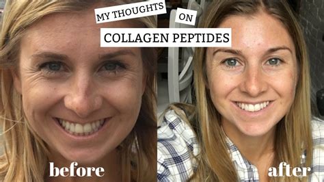 Best Collagen Peptides 2025: Industry Growth, Clinical Data & Top Product Comparison Guide